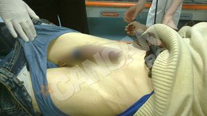 Un moldovean a ramas cu penisul blocat intr-o sticla! A incercat placeri interzise!