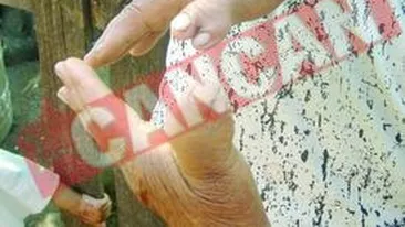 Tamaduitoarea cu 12 degete