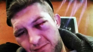 Fost fotbalist bătut cu sălbăticie într-un magazin! Imagini dure pe camerele de supraveghere