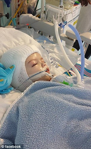 Emoţionant! Doi gemeni se privesc în ochi, după ce s-au născut lipiţi în zona capului