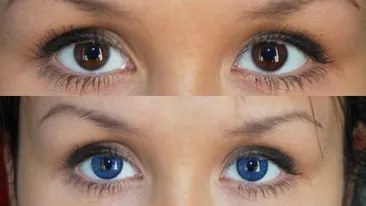 Porti lentile de contact? O femeie a fost la un pas de a-si pierde vederea din cauza lor