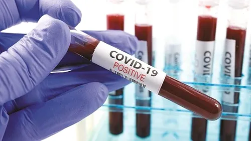Coronavirus România, 27 februarie. 54 de decese s-au înregistrat în ultimele 24 de ore