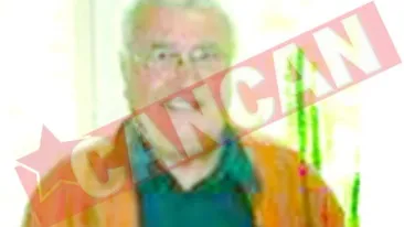 Care sunt simptomele tuberculozei?