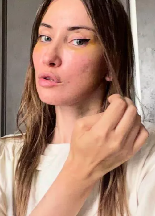 Iulia Albu, sinceră despre intervențiile estetice: „Fără filtre, fără vrăjeală”