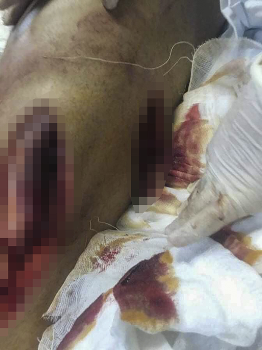 Bebino a ajuns pe masa de operație, cu răni grave
