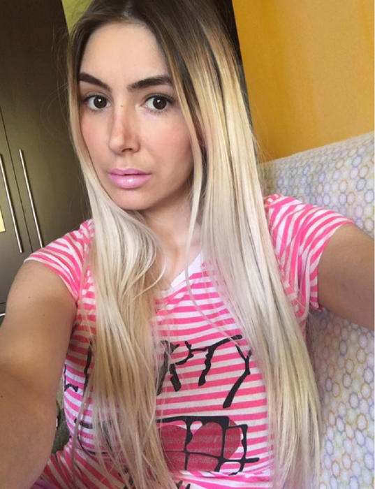 Prima imagine cu Sexy Brăileanca după ce și-a făcut intervenție estetică la nivelul feței