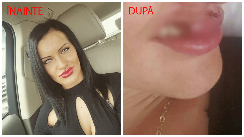 Emanuela a fost "măcelărită" de doctorul Kasem