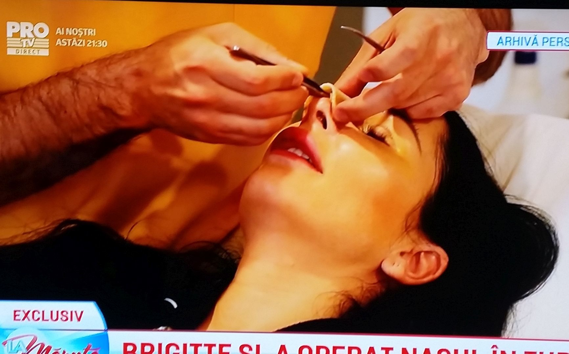 Brigitte le-a arătat tuturor imaginile din sala de operaţie.