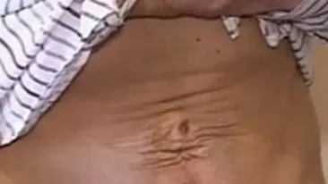 Mutilata pe viata! Afla prin ce drama a trecut o tanara din Craiova!