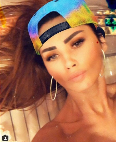Arunca cu vorbe grele spre botoxate, dar acum…. Oana Zăvoranu a apelat la botox. A recunoscut și UNDE și-a făcut intervenția!
