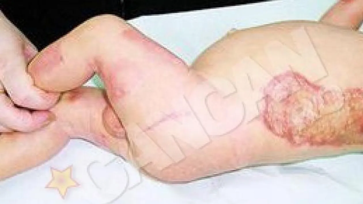 Va mai amintiti de bebelusul uitat in incubator? Alexandru se pregateste acum de o noua operatie!