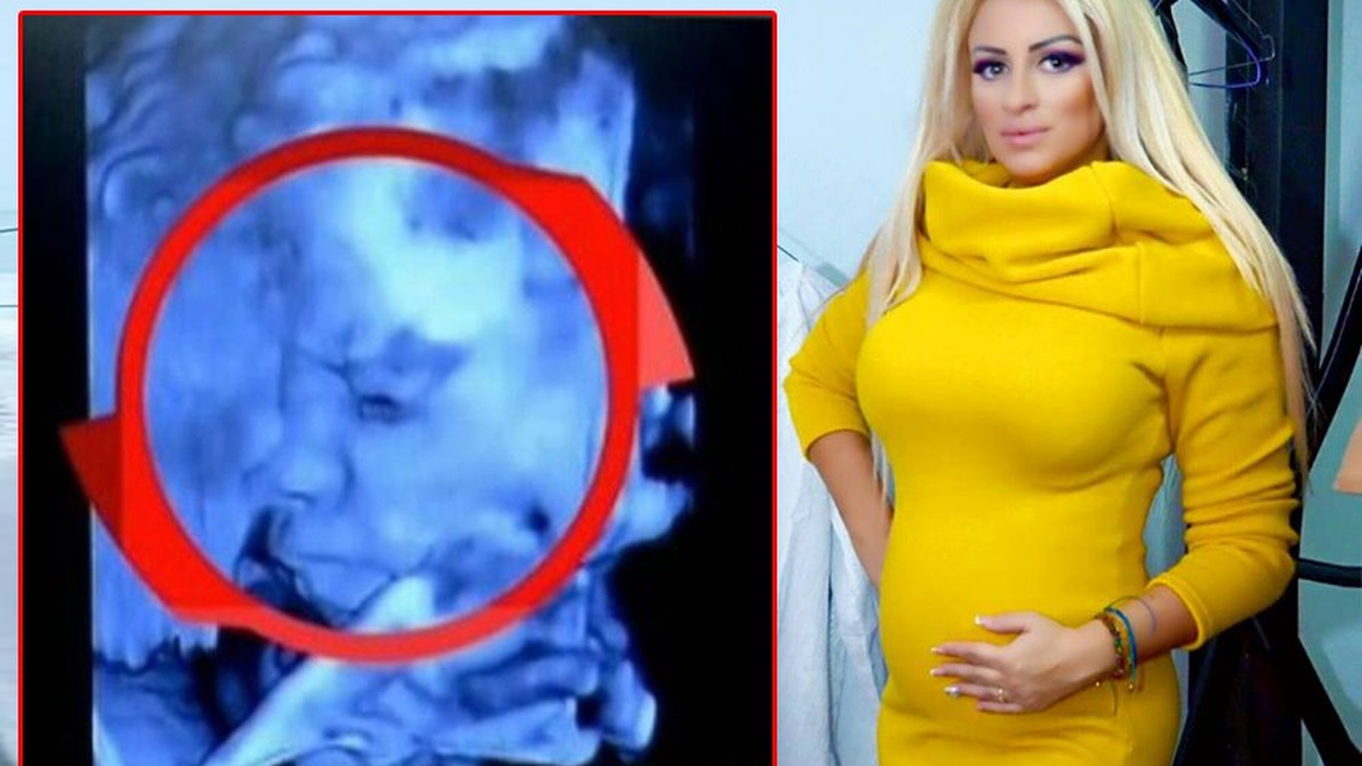 Sânziana Buruiană, însărcinată din nou?! A repostat poza cu ecografia: "Botoasa mică din burtică"