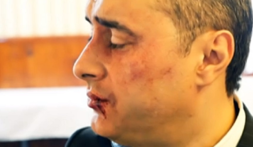 Marian Mexicanu’, rupt cu bătaia! “M-au așteptat, mi-au luat banii și…” Cum arată lăutarul în urma „corecției”