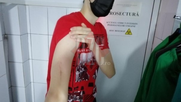 Un student, bătut pentru un loc de parcare în Cluj-Napoca de șoferul unui BMW. Agresorul nu este stăpân pe lotul pe care Andrei și-a pus mașina
