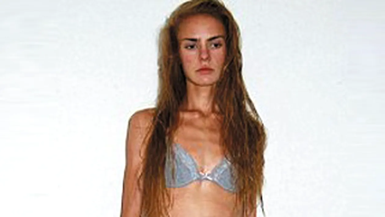 A vrut sa tina o dieta inainte de Craciun, a ajuns la anorexie si a murit