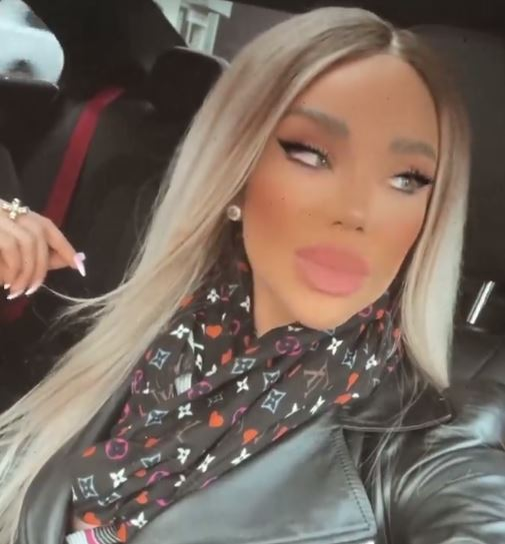 Bianca Drăgușanu, în sala de operații: “O rinoplastie și o schimbare de implant mamar”. Câți bani a investit în intervențiile estetice