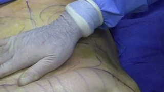 Liporexia, noua obsesie a femeilor care vor sa fie slabe!