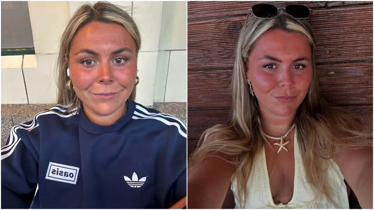 O sportivă de 24 de ani a murit după ce medicii i-au spus că are o alergie. Ce a pățit, de fapt