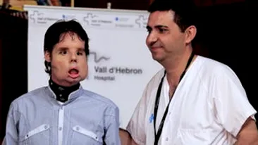 VEZI Aici cum arata barbatul caruia i s-a facut un transplant total de fata