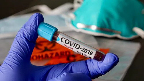 COVID-19 lovește cu putere Franța! În ultimele 24 de ore au fost raportate peste 6.000 de cazuri de infectare