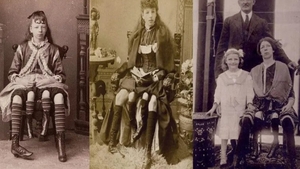 Cazul care a uimit o lume întreagă. Cine este Josephine Myrtle Corbin, femeia cu patru picioare