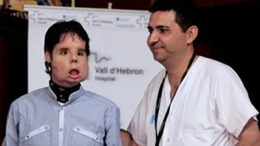 VEZI Aici cum arata barbatul caruia i s-a facut un transplant total de fata