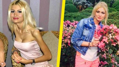 Anorexica Flavia Apostol s-a îgrăşat! În 2013 tânăra cântărea doar 35 de kilograme!