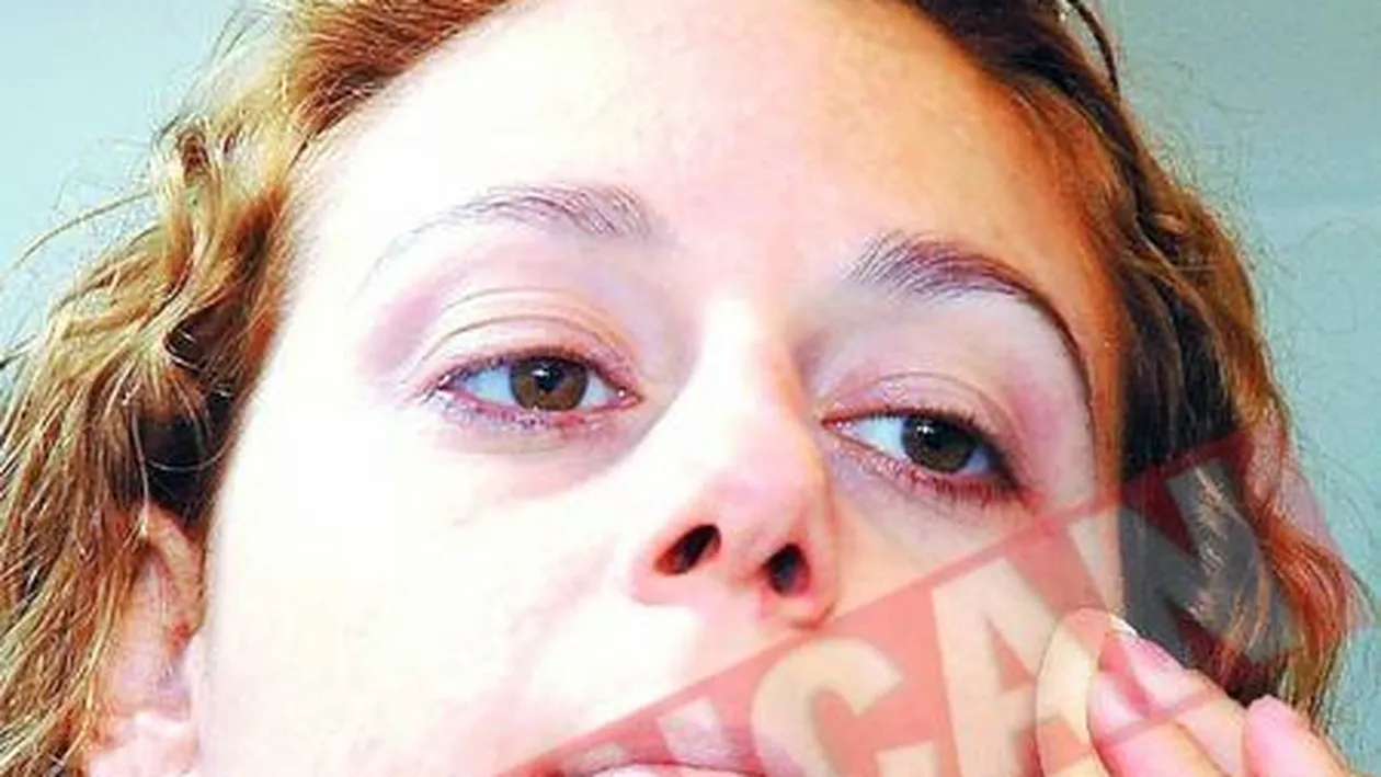 Sfaturi de ingrijire a pielii iarna