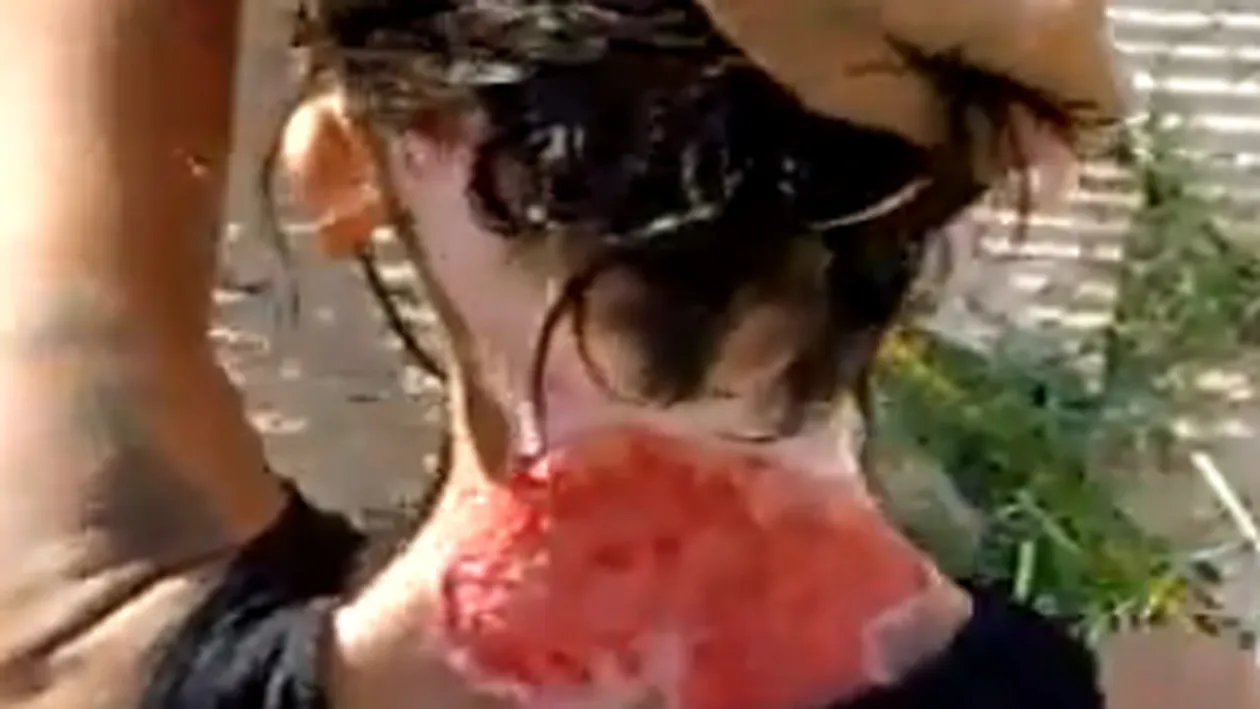 VIDEO Uite cum arata o drogata care s-a scarpinat pana la sange, dar spune ca a fost injunghiata
