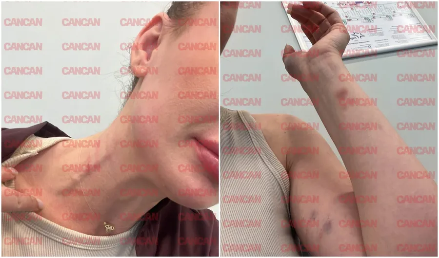 Tânăra prezintă urme de lovituri la nivelul brațelor și al gâtului