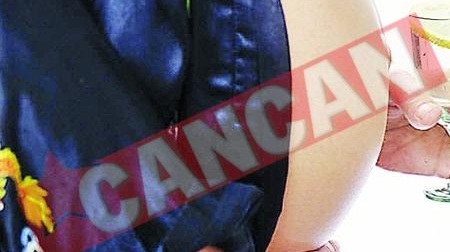 Femeile cu herpes genital trebuie sa nasca prin cezariana