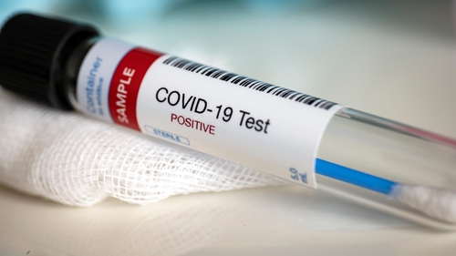 Coronavirus România, 23 aprilie 2021. Puțin peste 2500 de cazuri noi s-au înregistrat, în ultimele 24 de ore