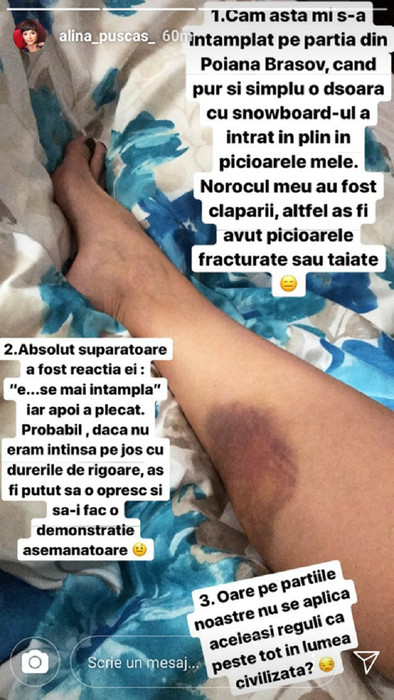 Alina Puşcaş, primele declaraţii despre accidentul violent de pe pârtia de schi: „Îmi taie carnea cu totul, iar când mi-am dat jos clăparul…”