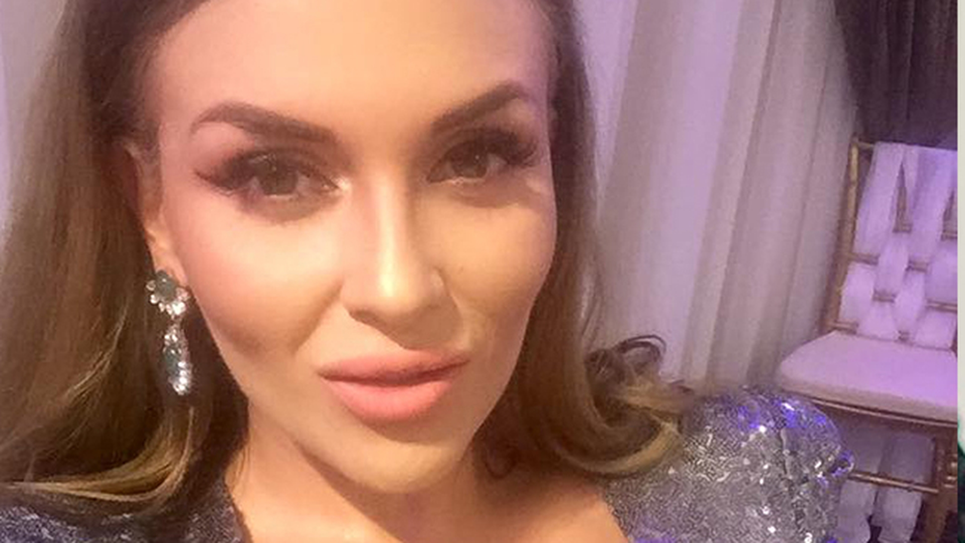 OANA RADU este în pragul disperării, după ce i s-a umflat falca cât pumnul! Vedeta a cerut ajutorul fanilor