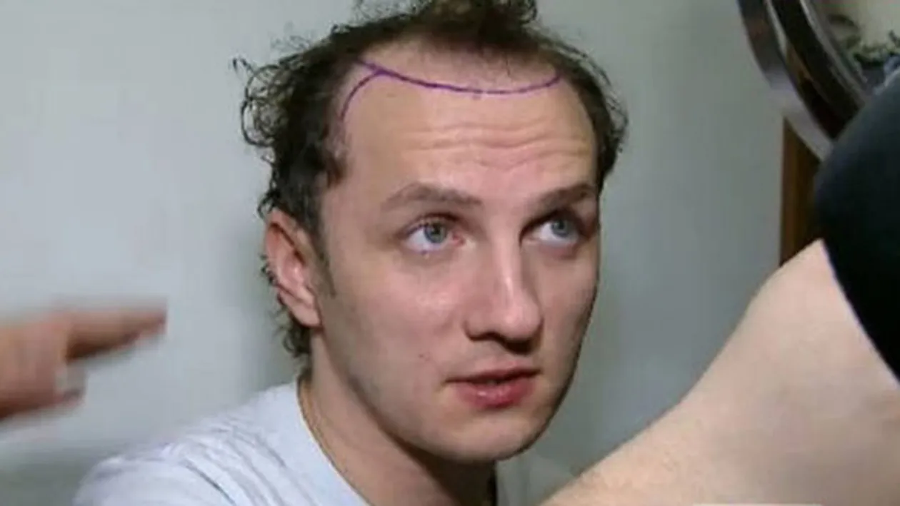 De cand si-a facut implant de par, Traistariu face ravagii printre femei! Artistul, agresat sexual: Vrea doar sa ma f...