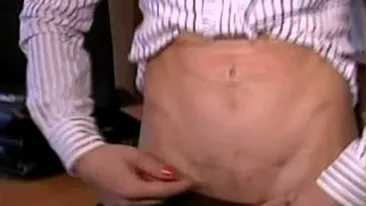 VIDEO O tanara din Craiova a fost mutilata de esteticianul care trebuia sa o faca mai frumoasa! S-a ales cu abdomenul plin de cicatrici!