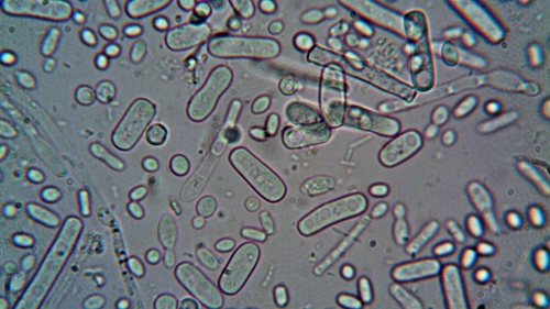 Bacteria care face tot mai multe victime în apele din America! Cinci oameni au murit deja