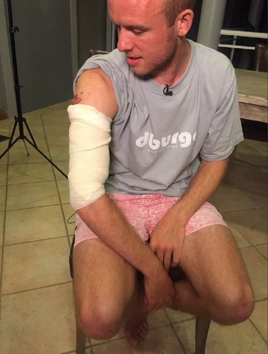 VIDEO / Un medic a bătut rechinul care a încercat să-i mănânce braţul drept: „L-am lovit cât de tare am putut şi apoi…”