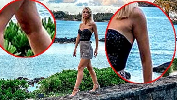 Andreea Bălan a fost bătută?! A apărut cu vânătăi suspecte pe corp