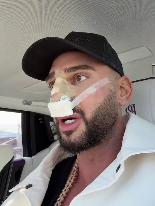Dorian Popa, la un pas să îi „cadă nasul ca lui Michael Jackson”! Ce i-a descoperit medicul la operație? „Habar nu aveam”