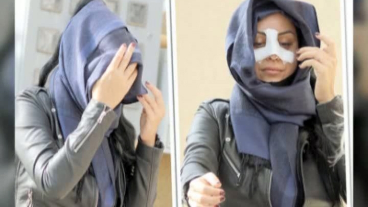 Primele imagini cu Daniela Crudu, la două săptămâni de la bătaie! Nu i-a mai păsat cum se îmbracă, a avut grijă doar să-și acopere vânătăile