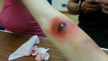 Vedeta din Romania care si-a ingrozit fanii cu aceste fotografii! Ce a patit artista