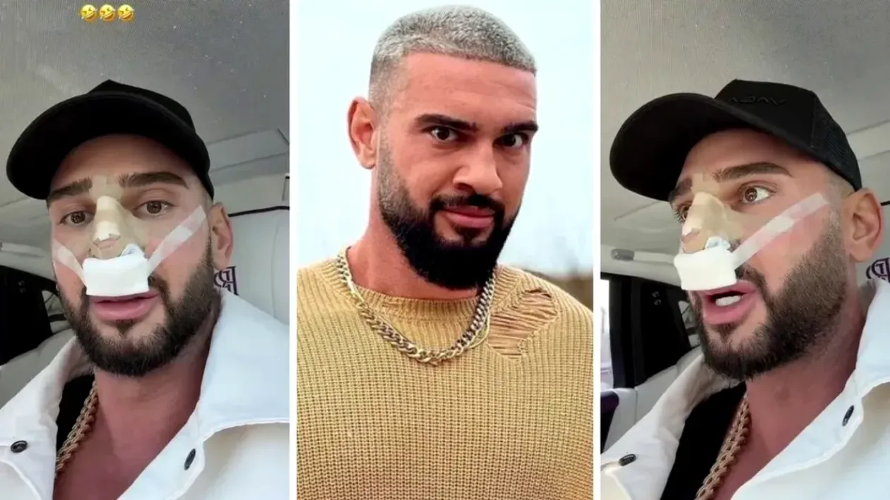 Dorian Popa și-a dat bandajele de la nas jos: „Am plâns ca un bebeluș.” Care este motivul?