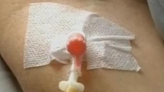 Un tanar din Sibiu a fost muscat de o capusa si acum este suspect de encefalita!