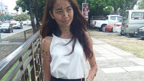 Această tânără a fost numită toată viaţa ei un „monstru“ din cauza felului în care arată, dar acum ar putea deveni următoarea Miss Univers!