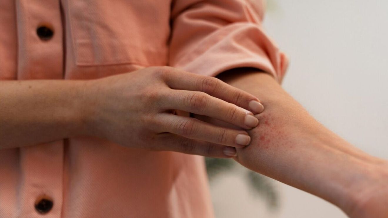 (P) Tratament pentru psoriazis ușor de urmat și integrat în rutina zilnică. Remisie îndelungată și efecte vizibile rapid