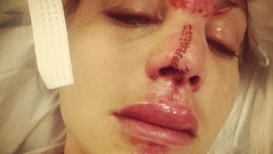 ŞOCANT! O gimnastă a fost desfigurată! Blonda superbă a fost mutilată după ce a încercat o cascadorie simplă!