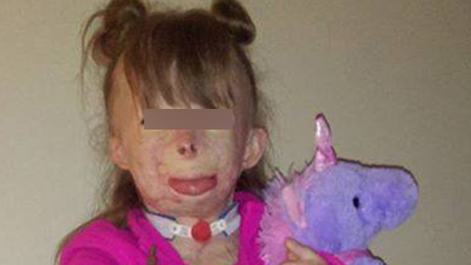 O fetita de 8 ani a fost mutilata de flacari! Cazul sau a impresionat o celebra vedeta