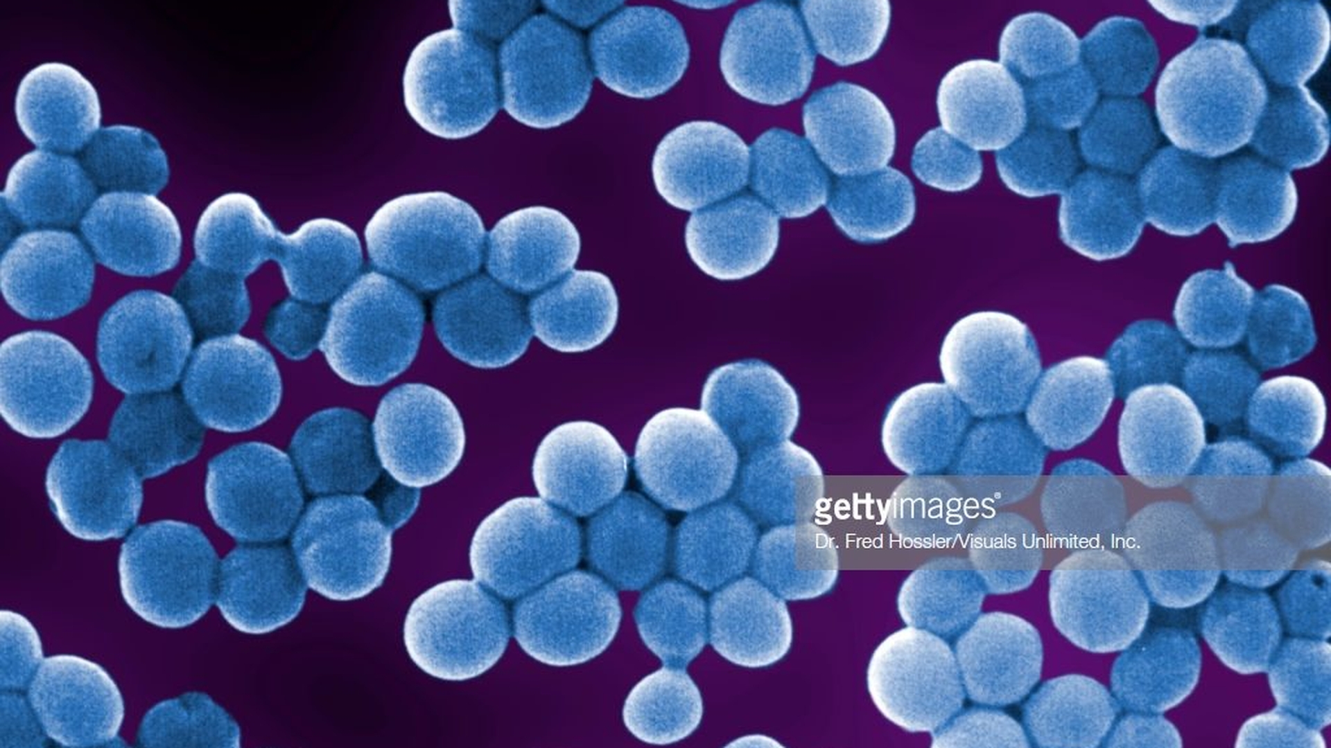 ALERTĂ! Bacteria ucigașă se poate răspândi în spitalele din lumea întreagă