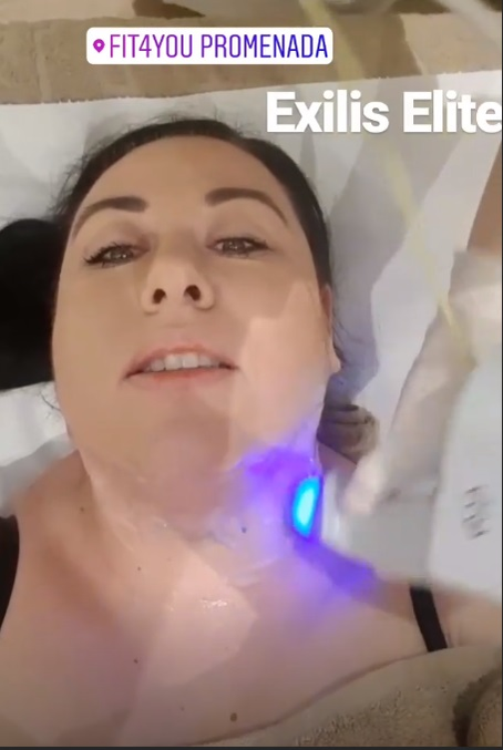 Oana Roman “și-a sculptat” fața! S-a filmat în timpul procedurii estetice
